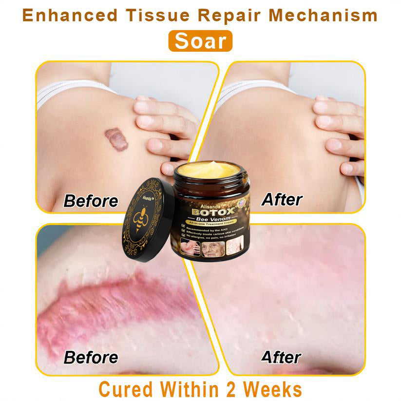 "Made and Shipped from USA | Alisanda™ BOTOX Bee Venom All-in-one Treatment Cream | LAST DAY 70% OFF "