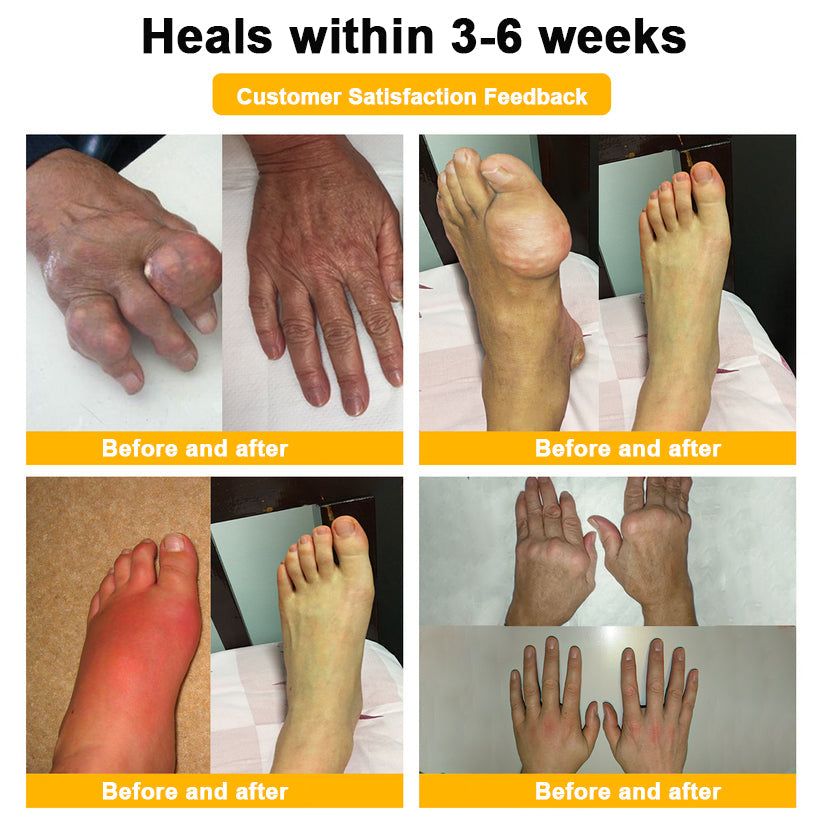 AQA™ Botulinum & Bee Essence Pain-Relief Bone Healing Cream