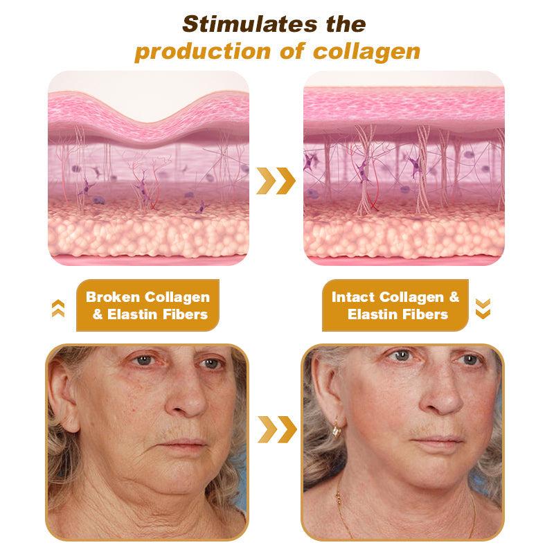 "Made and Shipped from USA | Alisanda™ BOTOX Bee Venom All-in-one Treatment Cream | LAST DAY 70% OFF "