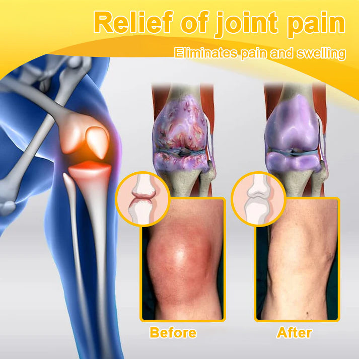 AQA™ Botulinum & Bee Essence Pain-Relief Bone Healing Cream