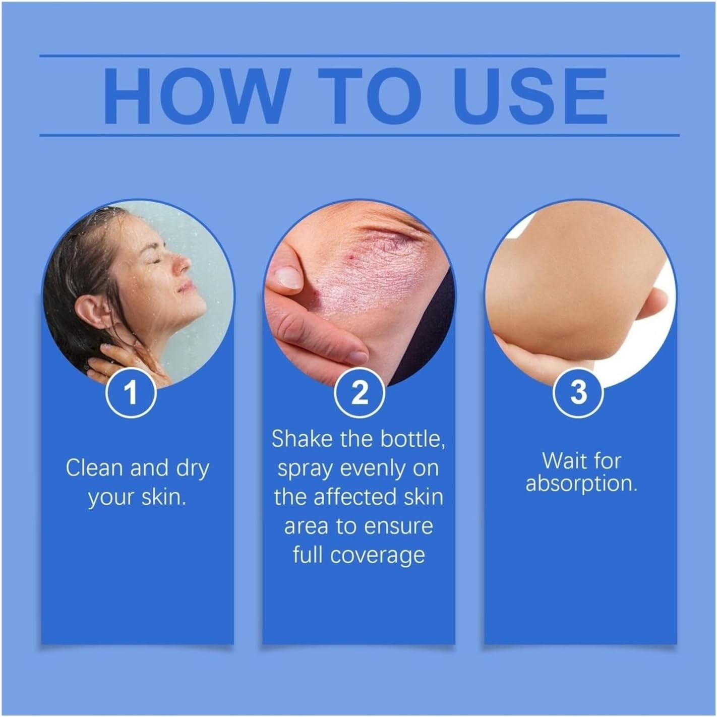 ✨【 official Brand Store】 Last Day Discount: 83% OFF 🌸 LOVILDS™ PsoriaHeal psoriasis Spray pro