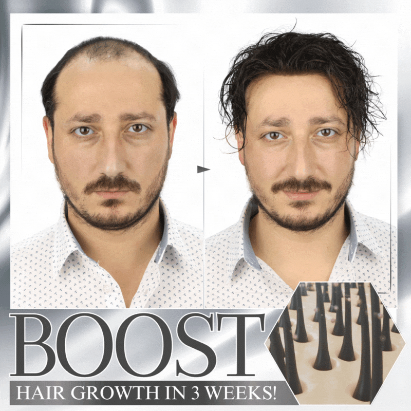 đĽLast Day DiscountđĽ LOVILDS⢠Anti-Shedding Hair Sprayđââď¸đ§