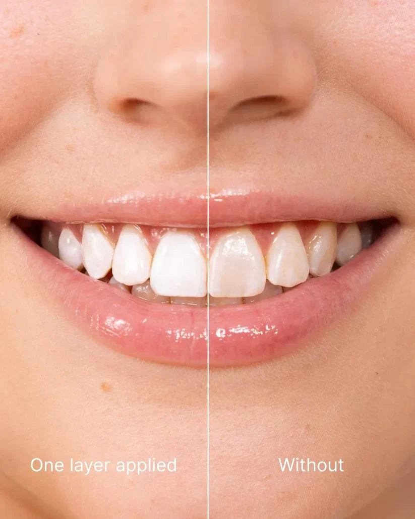 Miraloud™ Tooth Polish - Instant Clean Smile