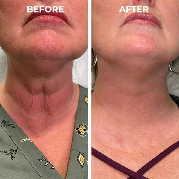 Final HoursāSale Ending Soon!š„LOVILDS Renewal Skin Cream | Spot Removal & Skin Renewal for Dark Spots, Age Spots, and Sun Spots* Daily Firming for All Skin Types