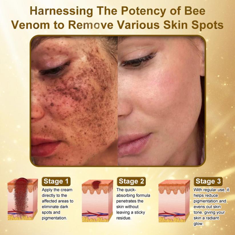 "Made and Shipped from USA | Alisanda™ BOTOX Bee Venom All-in-one Treatment Cream | LAST DAY 70% OFF "