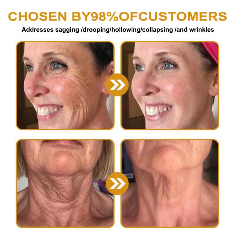 "Made and Shipped from USA | Alisanda™ BOTOX Bee Venom All-in-one Treatment Cream | LAST DAY 70% OFF "