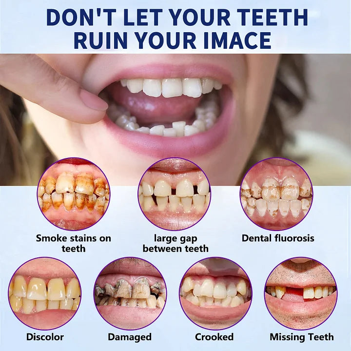 NESLEMY-🦷Advanced Customized Full Denture Set🦷(⏰Limited timediscount last 30 minutes⏰)