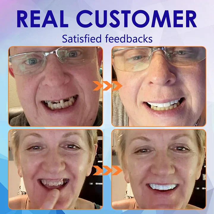 NESLEMY-🦷Advanced Customized Full Denture Set🦷(⏰Limited timediscount last 30 minutes⏰)