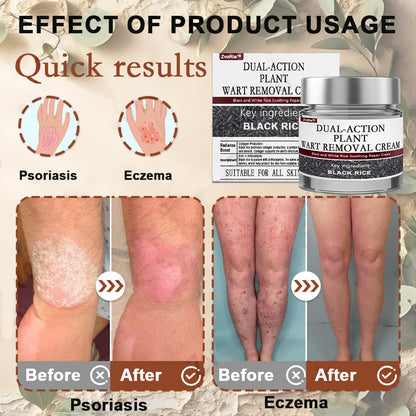ZvoRia™ Black Rice Skin Repair Essence Cream ⚕️ FDA Certified (Eliminates warts and skin tags, relieves psoriasis, improves keratin build-up and follicular keratinization, fades pigmentation, sun spots & age spots)