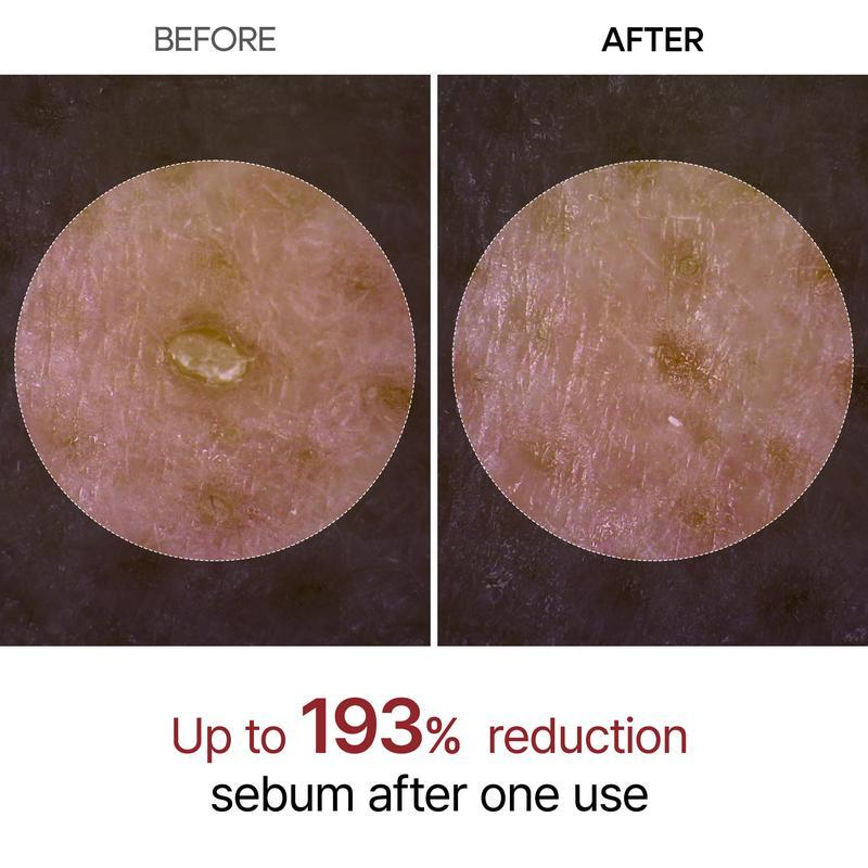 LOVILDS Authoritative Certification! Peel Shot Glow Rice Ampoule Duo - Developed and backed by board-certified dermatologists