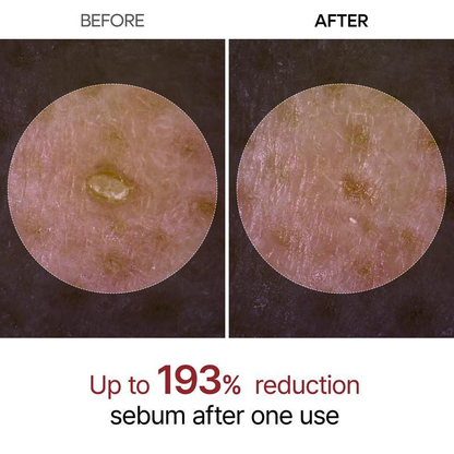 LOVILDS Authoritative Certification! Peel Shot Glow Rice Ampoule Duo - Developed and backed by board-certified dermatologists