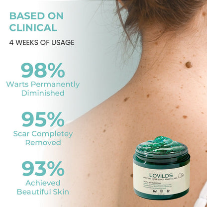 ✅ Official Store:  Ultra LOVILDS™ Instant Mole & Spot Removal Gel