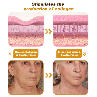 "Made and Shipped from USA | Alisanda™ BOTOX Bee Venom All-in-one Treatment Cream | LAST DAY 70% OFF "