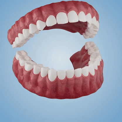 NESLEMY-🦷Advanced Customized Full Denture Set🦷(⏰Limited timediscount last 30 minutes⏰)