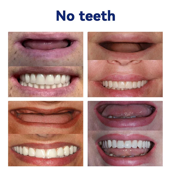 NESLEMY-🦷Advanced Customized Full Denture Set🦷(⏰Limited timediscount last 30 minutes⏰)