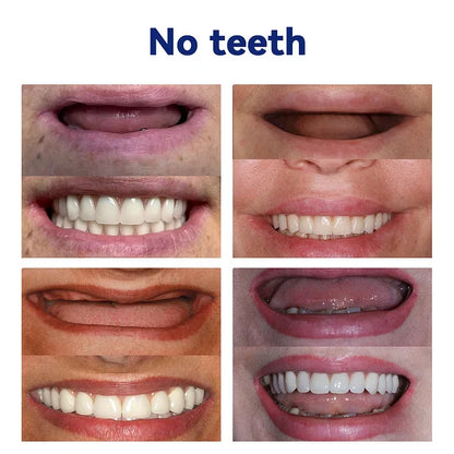 NESLEMY-🦷Advanced Customized Full Denture Set🦷(⏰Limited timediscount last 30 minutes⏰)
