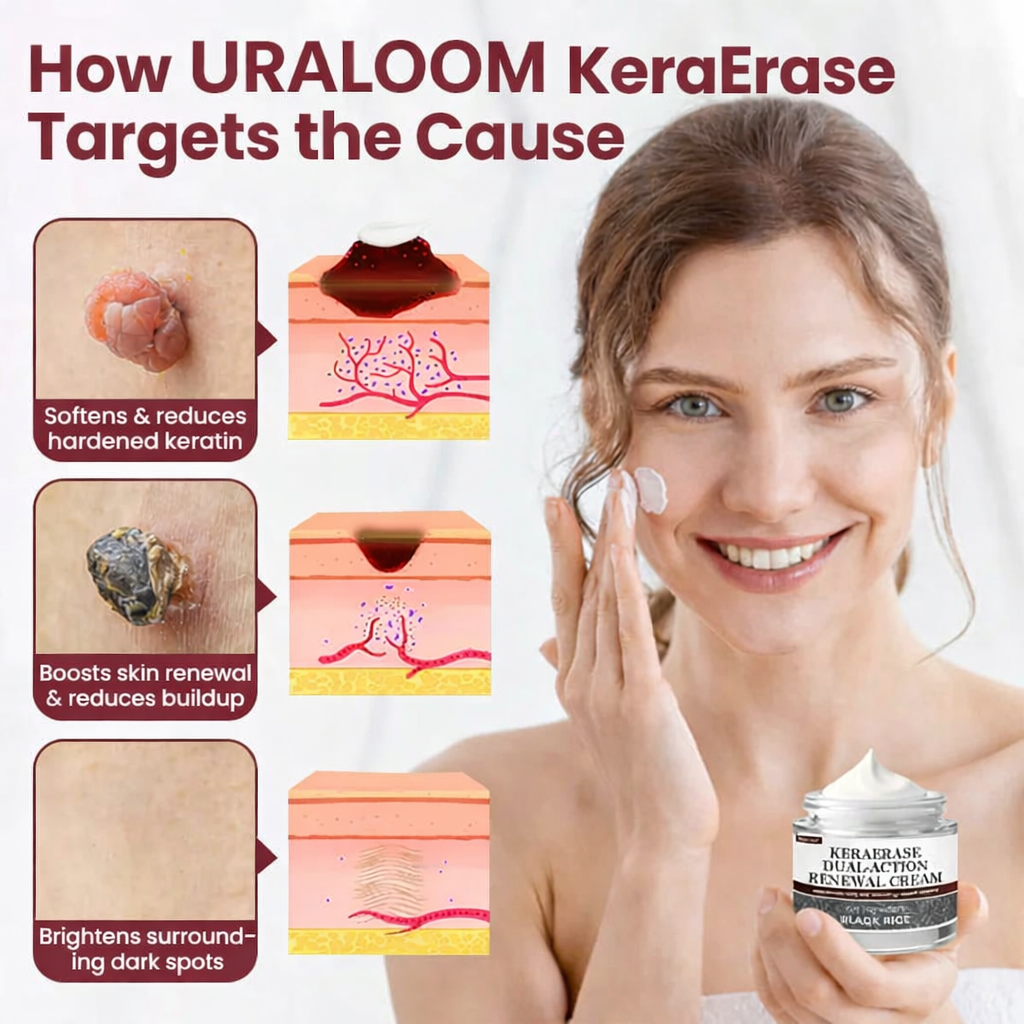 ✅Flash Sale - URALOOM®KeraErase Dual-Action Renewal Cream