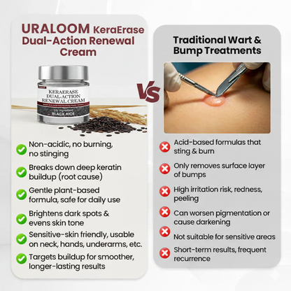✅Flash Sale - URALOOM®KeraErase Dual-Action Renewal Cream