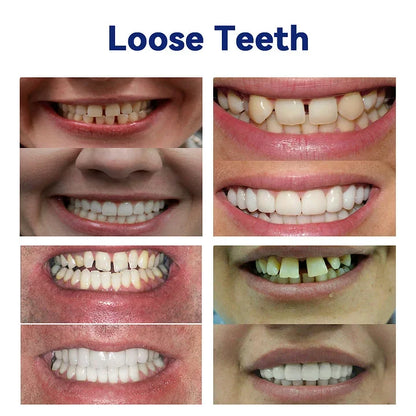 NESLEMY-🦷Advanced Customized Full Denture Set🦷(⏰Limited timediscount last 30 minutes⏰)
