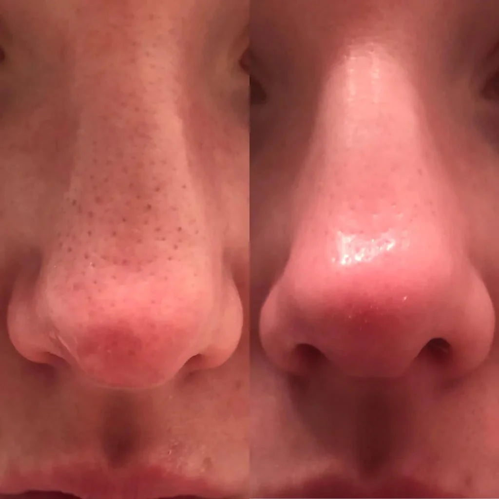 LOVILDS Authoritative Certification! Peel Shot Glow Rice Ampoule Duo - Developed and backed by board-certified dermatologists