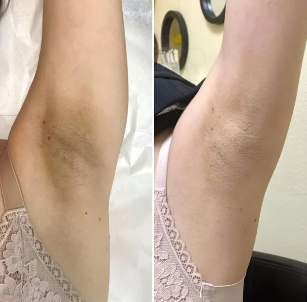 LOVILDS Authoritative Certification! Peel Shot Glow Rice Ampoule Duo - Developed and backed by board-certified dermatologists